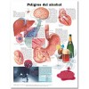 Dangers of Alcohol in Spanish (Peligros del alcohol) Anatomical Chart